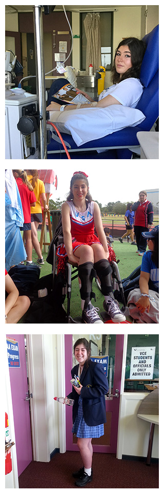 Image 1 - Jessica undergoing treatment. Image 2 - Jessica sat in her wheelchair. Image 3 - Jessica stood up at school.